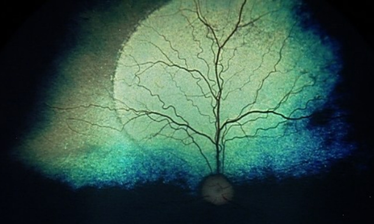 Small tree growing from a round root ball with numerous branching limbs against a teal-blue glowing backdrop.