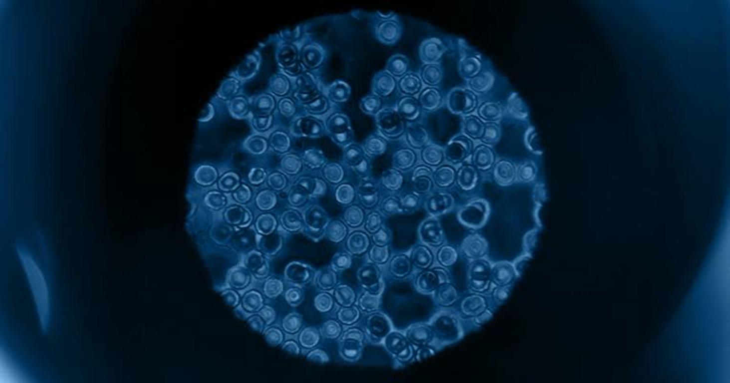 Blue-tinted microscopic view of many small round cells densely packed in a circular field.