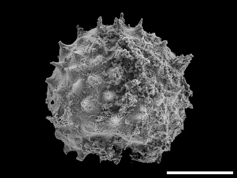 Scanning electron micrograph of a rough, spiky spherical particle on a black background; scale bar at bottom right.