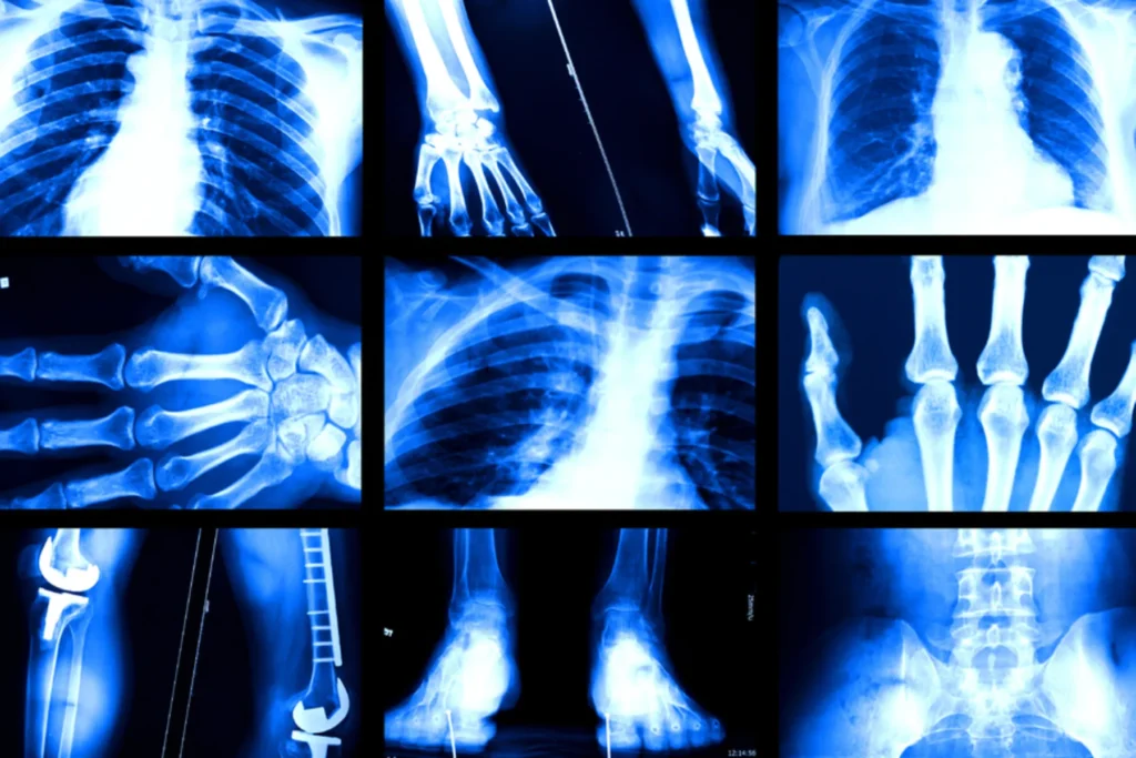 تعصب هوش مصنوعی در تحلیل تصاویر پزشکی