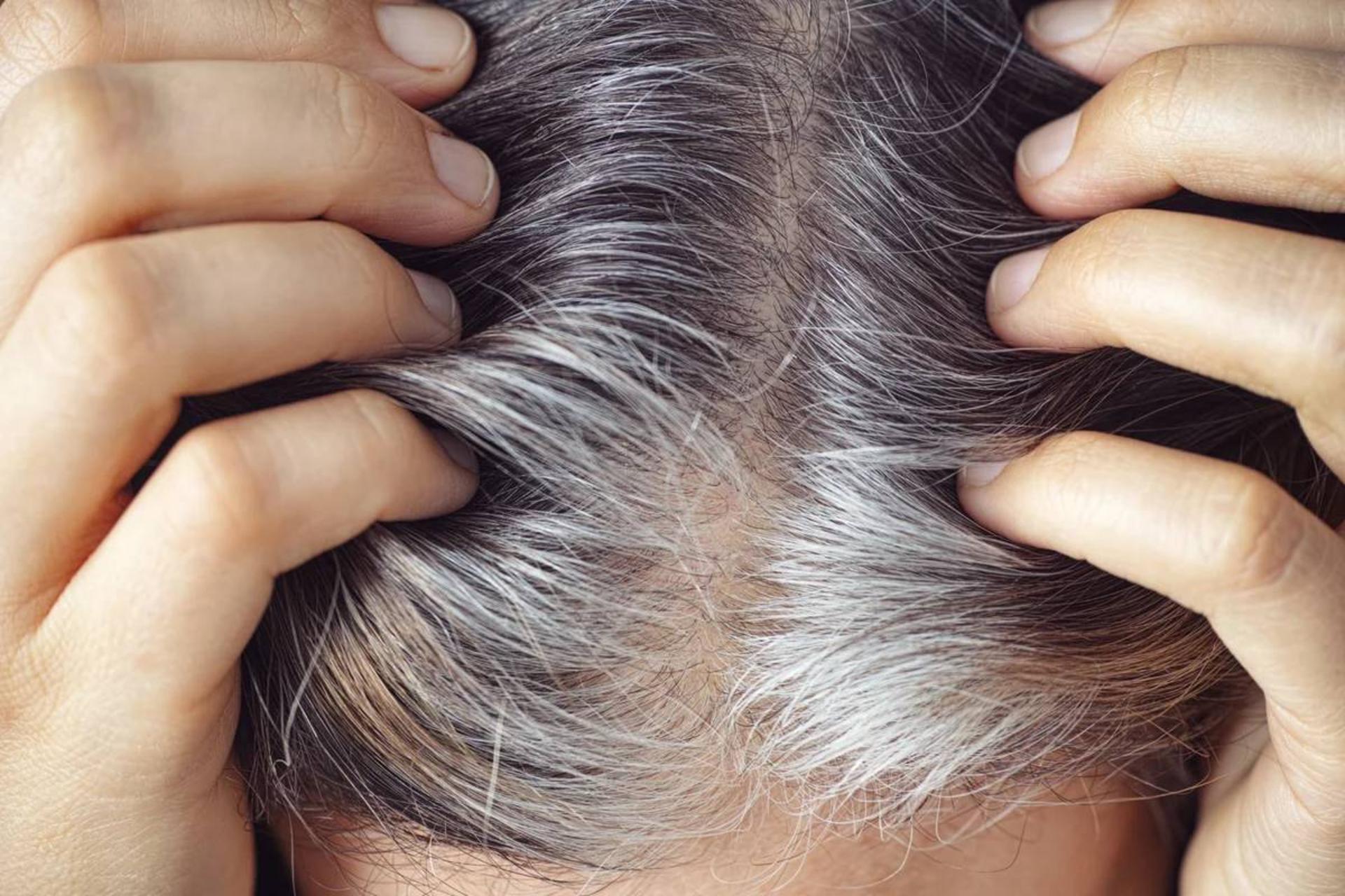 خاکستری‌شدن موها احتمالاً رویکرد طبیعی بدن برای مقابله با سرطان است