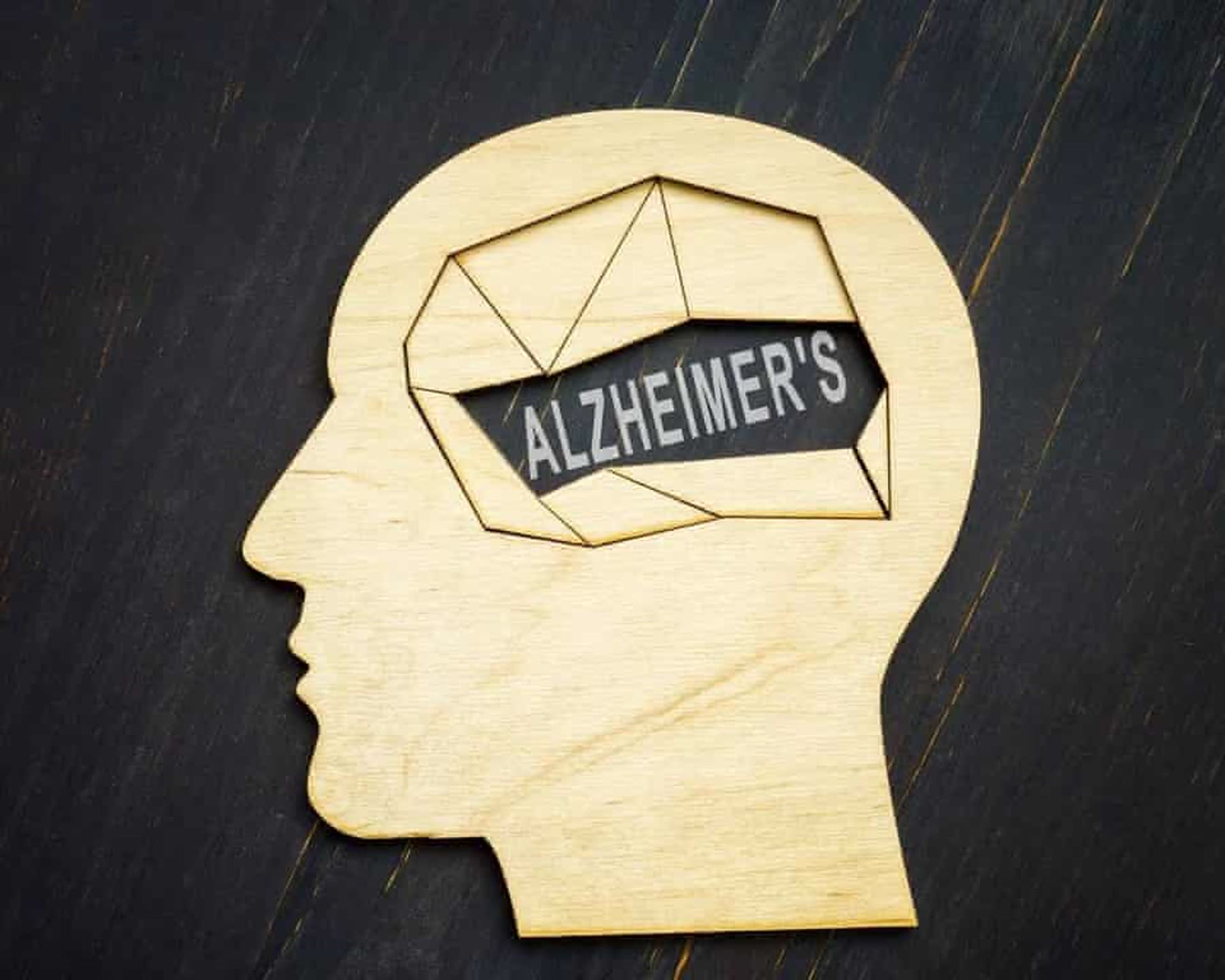 آزمایش داروی آلزایمر با هدف پیشگیری از بیماری آغاز شد